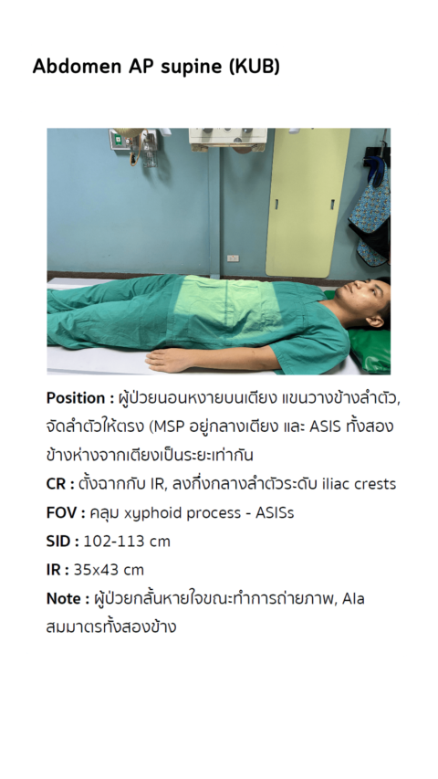 Abdomen AP supine (KUB) | VJR RTtech